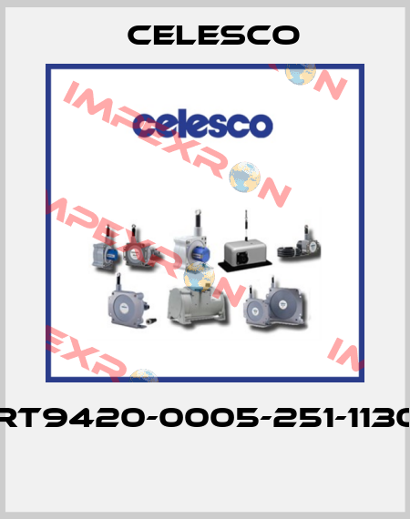RT9420-0005-251-1130  Celesco